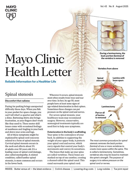 Title details for August 2025. Mayo Clinic Health Letter by Mayo Clinic - Wait list